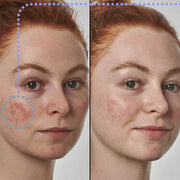 THE INKEY LIST Super Solutions 10% Azelaic Acid Serum 30ml
