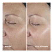 Smart Clinical Repair Wrinkle Correcting Serum