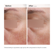 Niacinamide 5% Face and Body Emulsion