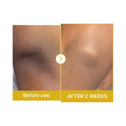 Medicube Kojic Acid Turmeric Body Peel Shot