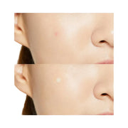 COSRX Acne Pimple Master Patch - Original Care