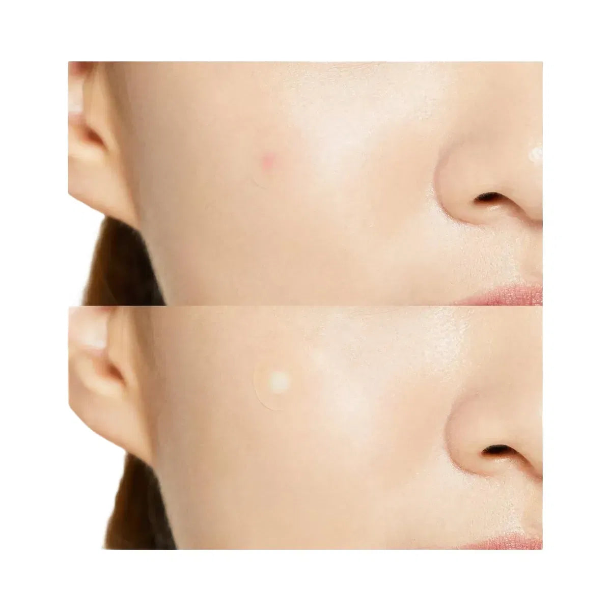 COSRX Acne Pimple Master Patch - Original Care