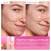 Watermelon Glow Dewy Skin Routine Gift Set (Holiday Limited Edition)