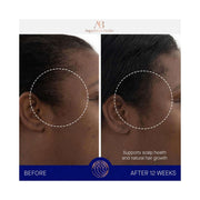 Augustinus Bader The Scalp Treatment (30 ml) - Augustinus Bader