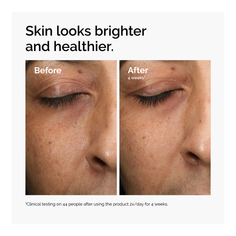 Multi-Antixoidant Radiance Serum