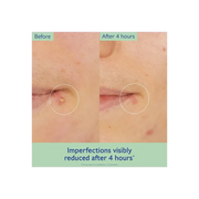 Caudalie Vinopure Targeted Spot Solution With Salicylic Acid