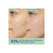 Caudalie Vinopure Oil-Control Moisturizer For Acne Prone Skin