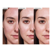 Avocado Ceramide Recovery Serum