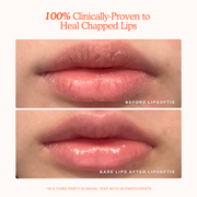 LipSoftie® Lip Treatment