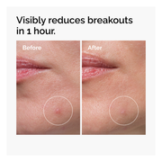 Sulfur 10% Powder-To-Cream Concentrate