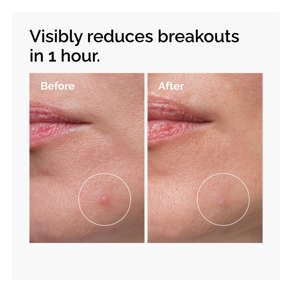 Sulfur 10% Powder-To-Cream Concentrate