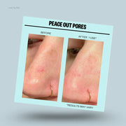 PEACE OUT DARK SPOTS