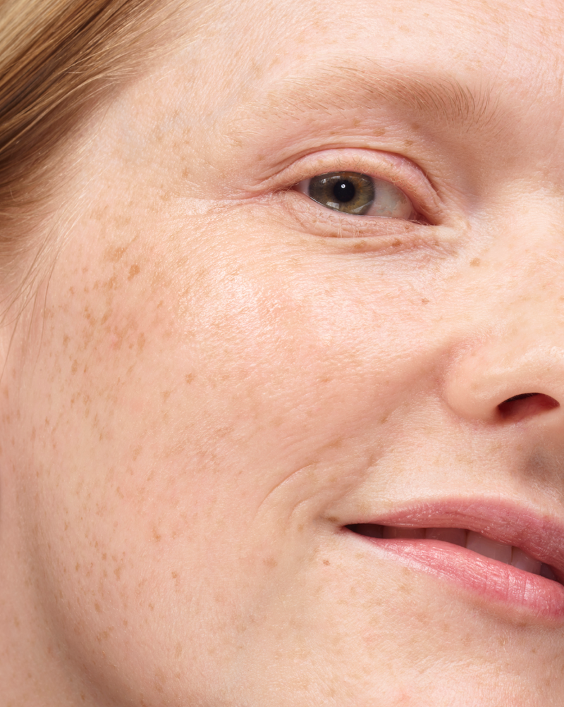 Universal Pro-Retinol